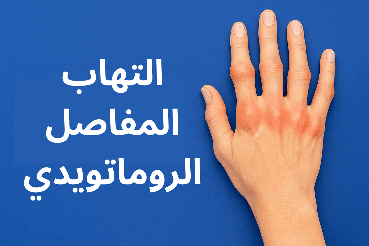 رسم توضيحي طبي يشرح التهاب المفاصل الروماتويدي، يُظهر المفاصل المصابة والالتهاب بوضوح – الكلمة المفتاحية: التهاب المفاصل الروماتويدي