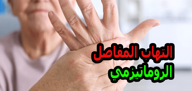 التهاب المفاصل الروماتيزمي