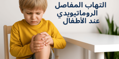 صورة توضيحية لطفل يعاني من آلام وتورم في الركبة، ممسكًا بركبته المتورمة، تمثل حالة التهاب المفاصل الروماتويدي عند الأطفال.